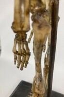 @JUG
<br/>
Skeleton of a foetus from about the seventh month
<br/>
<em>Tramond</em>